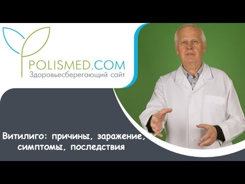 Видео о препарате Монобензон Беноквин мазь 30г
